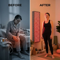 Red Light Therapy Panel Device – 660Nm Red & 850Nm near Infrared Light Therapy, LED Light Therapy Lamp, 300 Dual Chip Leds, Timer, Hanging Kit Included – PRO1500 — Before & After